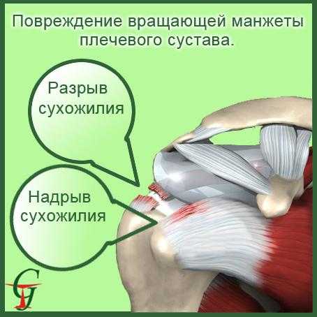 Корригирующие упражнения при повреждениях плеча | fpa