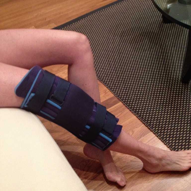 Строение колена. коленный сустав лечение, лечение травмы колена