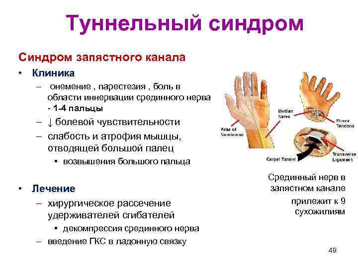 Как накачать кисти рук в домашних условиях, упражнения для кистей рук и пальцев