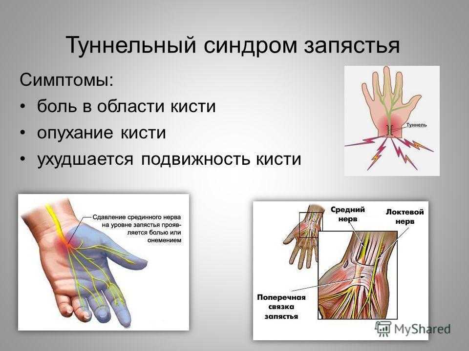 Как укрепить запястья рук: лучшие упражнения. | бомба тело