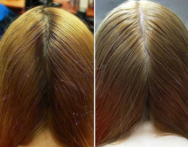 Ополаскивание волос ромашкой польза