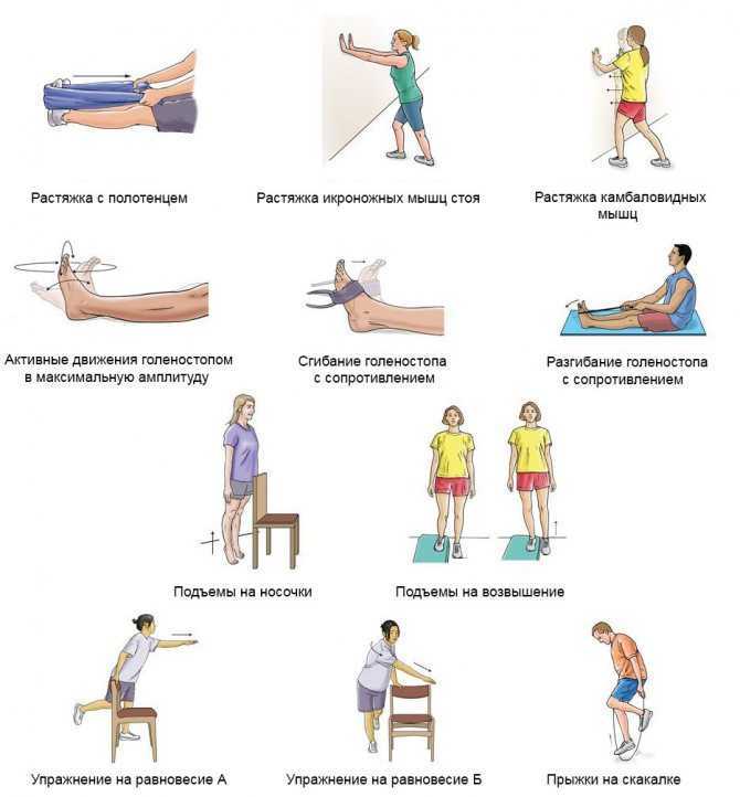 Комплекс упражнений для укрепления и восстановления коленных суставов и мышц Физические упражнения при артрозе и других проблемах коленей Техника, нюансы