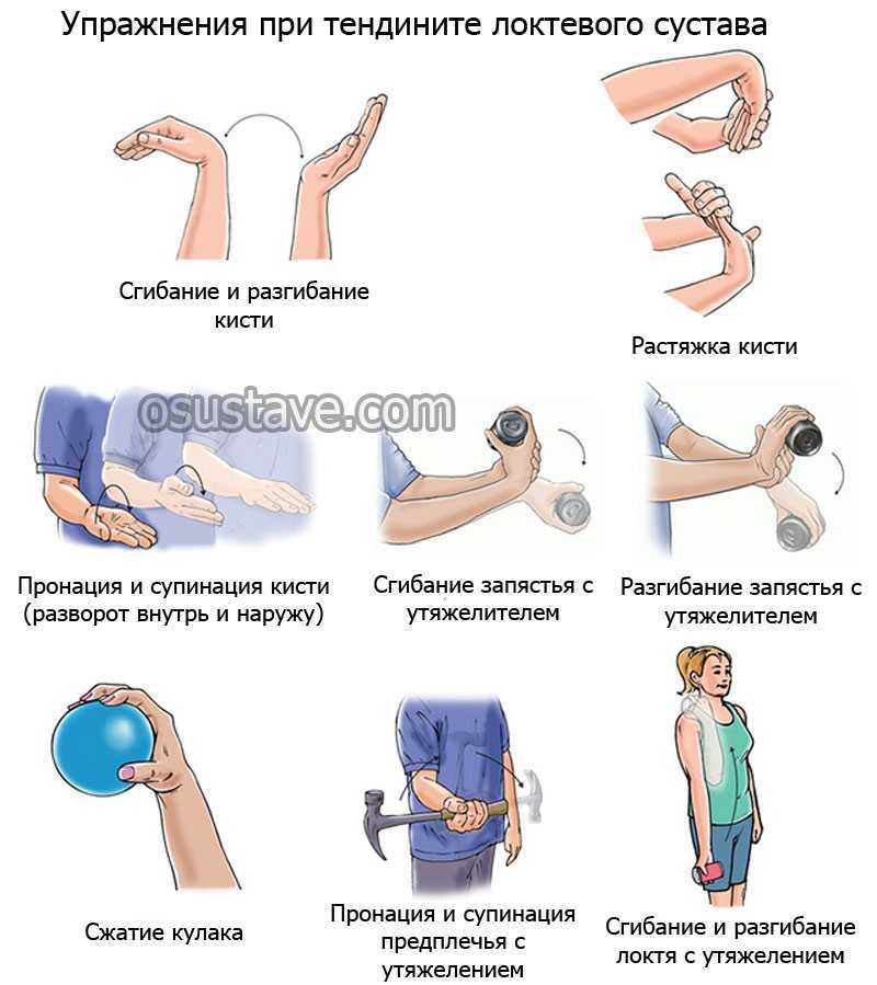 Плечевой сустав. повреждения и лечение