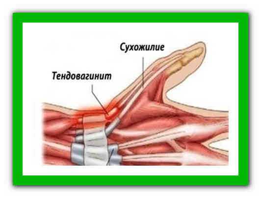 Как накачать кисти рук, укрепить пальцы и запястья в домашних условиях Комплекс упражнений для эффективного развития мышц и сухожилий, рекомендации