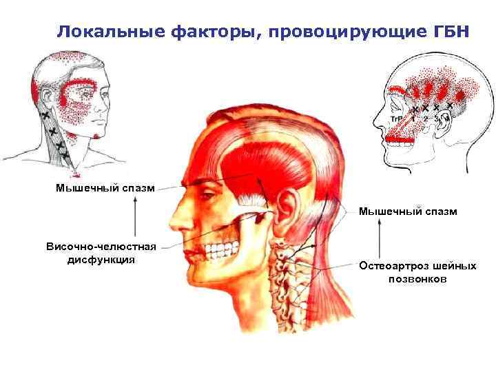 Сотрясение мозга: больше чем просто головная боль