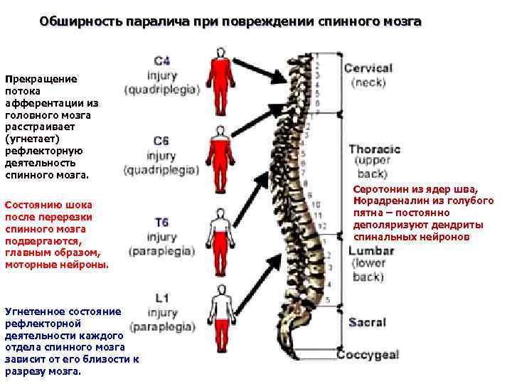 Травма спинного мозга