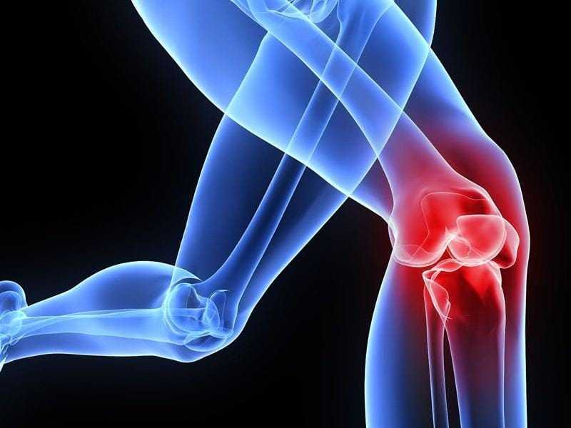 Как себя вести, если болят колени после бега – что предпринять, как вылечить, - подскажут специалисты