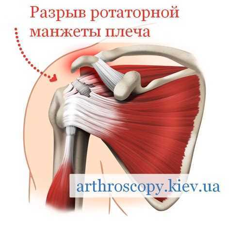 Травмы плеча и плечевого сустава: анатомия, симптомы и реабилитация