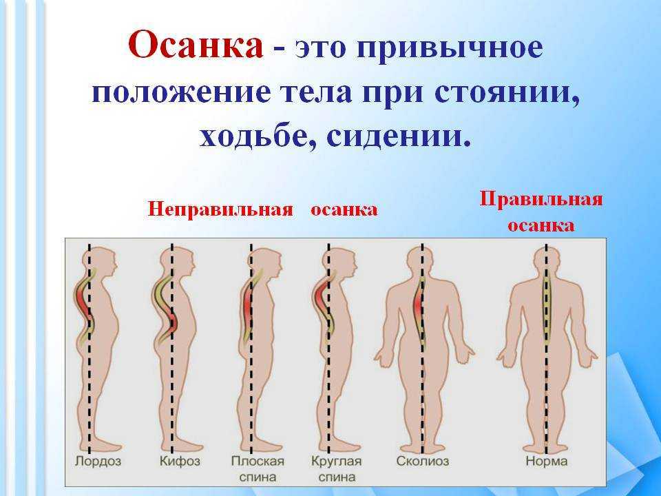 Фото правильной осанки и неправильной осанки