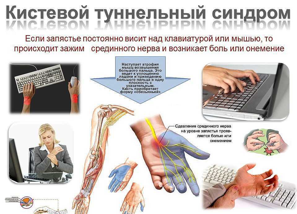 Синдром запястного канала. обзорная статья | medtran.ru