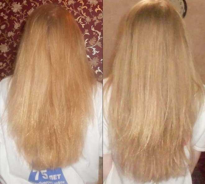 Ромашка для волос. осветление и окрашивание волос ромашкой: отвар и настой ромашки для волос. лечение волос ромашкой